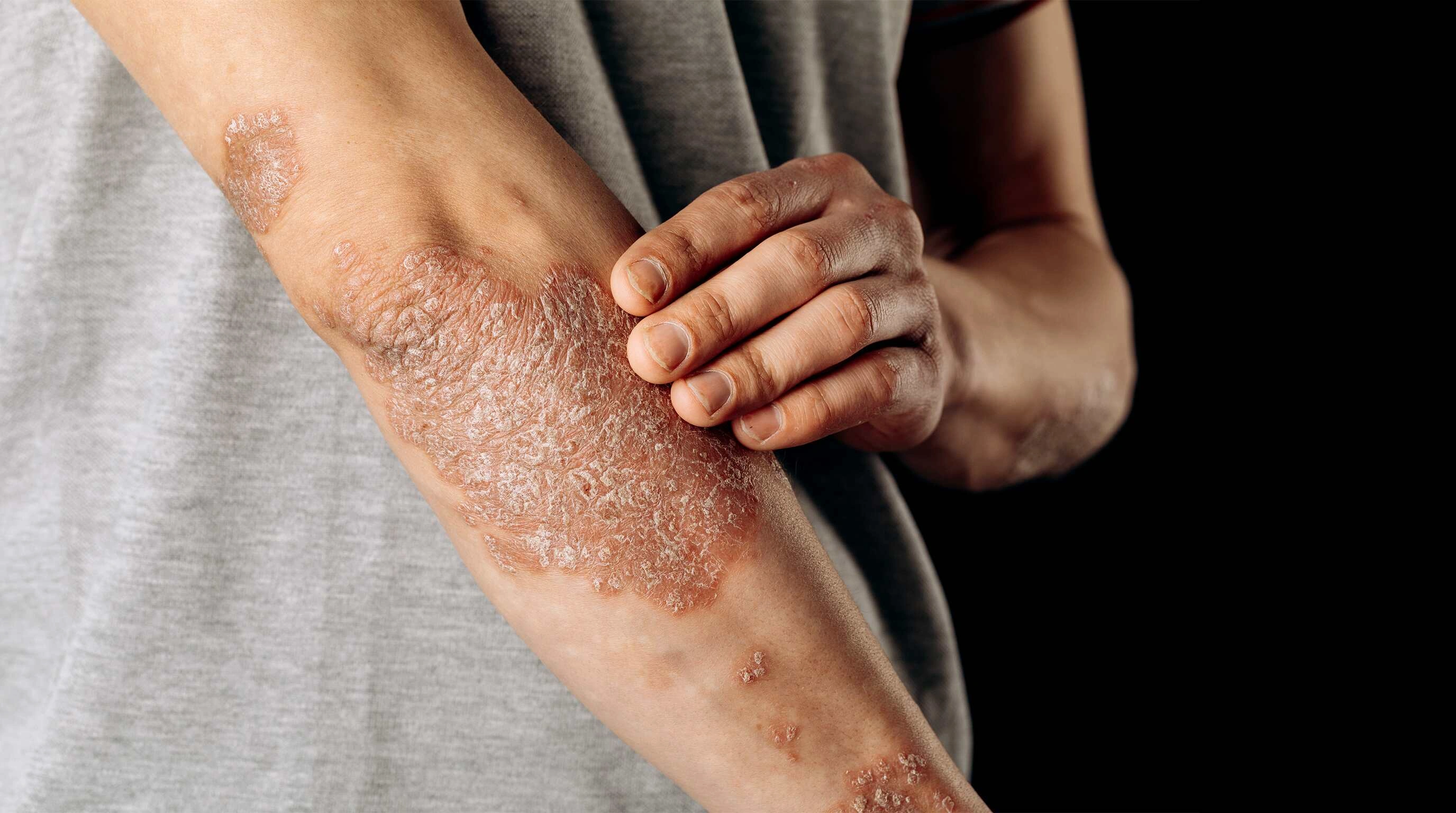 Therapeutic wellness retreats